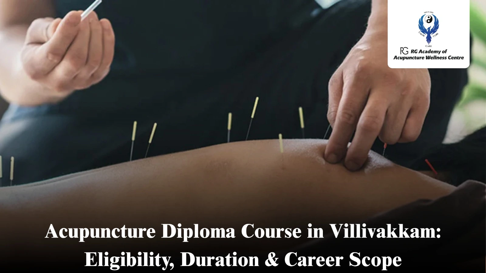 Acupuncture Diploma Course in Villivakkam | RG Academy
