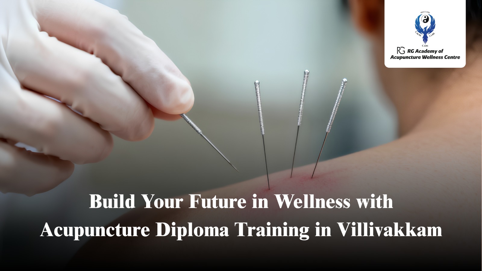 Acupuncture Diploma Training in Villivakkam | RG Academy Chennai
