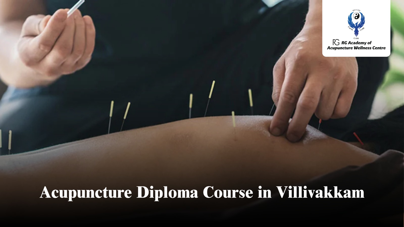 Acupuncture Diploma Course in Villivakkam | RG Academy – Enroll Now